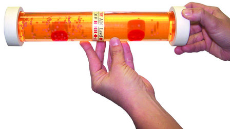 Hemoglobine A1C Model